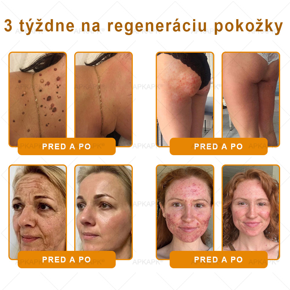 Odporúčané Univerzitnou nemocnicou Bratislava · Vyrobené na Slovensku✨✨ 𝖠𝖯𝖪𝖠𝖯𝖪® regeneračný krém na pokožku s včelím jedom