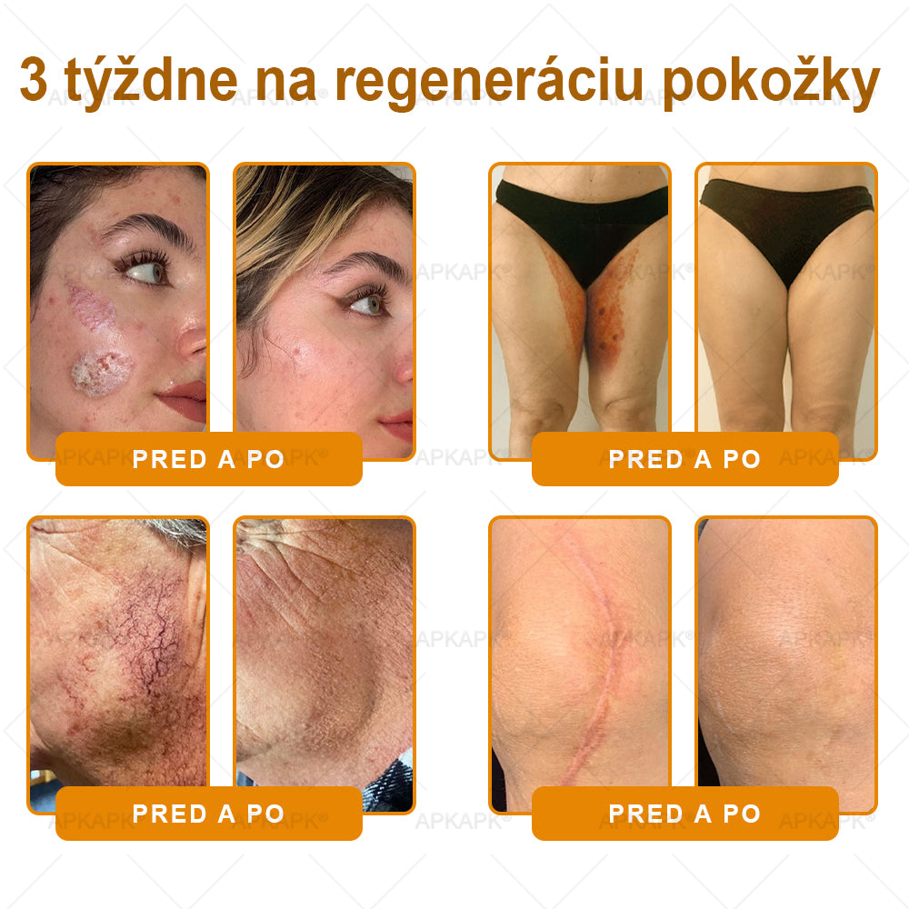 Odporúčané Univerzitnou nemocnicou Bratislava · Vyrobené na Slovensku✨✨ 𝖠𝖯𝖪𝖠𝖯𝖪® regeneračný krém na pokožku s včelím jedom