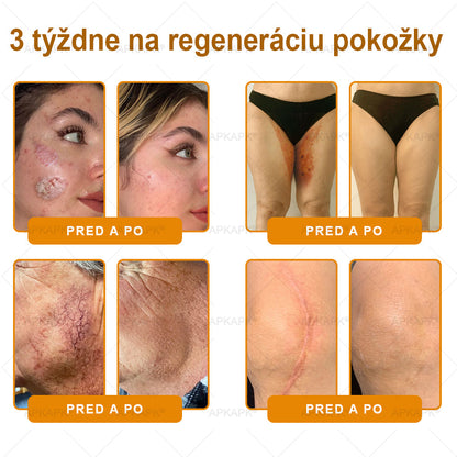 Odporúčané Univerzitnou nemocnicou Bratislava · Vyrobené na Slovensku✨✨ 𝖠𝖯𝖪𝖠𝖯𝖪® regeneračný krém na pokožku s včelím jedom
