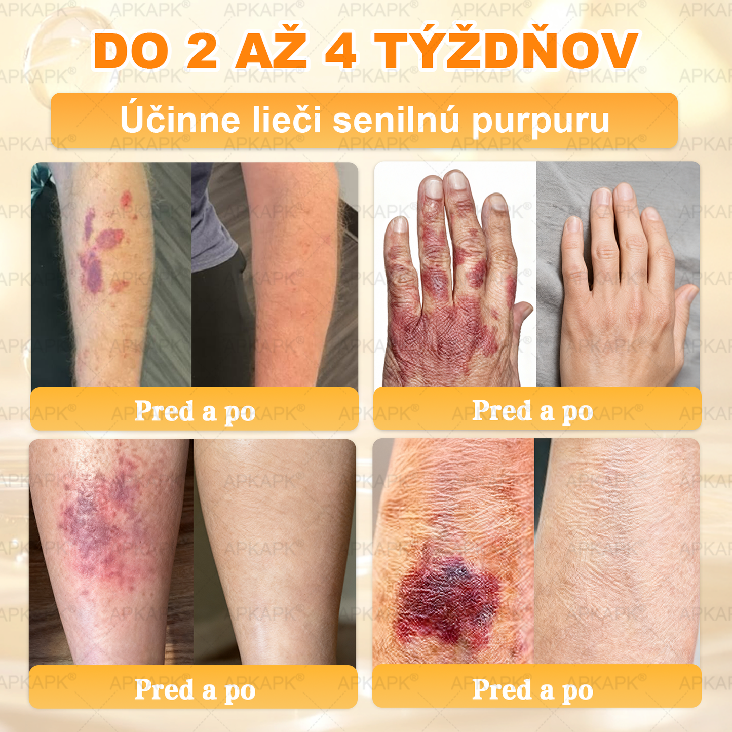 Odporúčané Univerzitnou nemocnicou Bratislava · Vyrobené na Slovensku✨✨ 𝖠𝖯𝖪𝖠𝖯𝖪® regeneračný krém na pokožku s včelím jedom