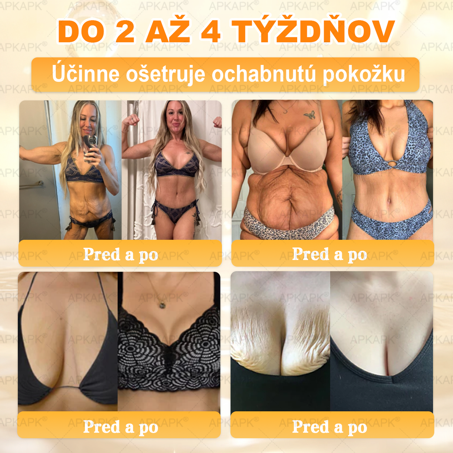 Odporúčané Univerzitnou nemocnicou Bratislava · Vyrobené na Slovensku✨✨ 𝖠𝖯𝖪𝖠𝖯𝖪® regeneračný krém na pokožku s včelím jedom