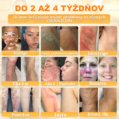 Odporúčané Univerzitnou nemocnicou Bratislava · Vyrobené na Slovensku✨✨ 𝖠𝖯𝖪𝖠𝖯𝖪® regeneračný krém na pokožku s včelím jedom