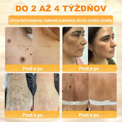 Odporúčané Univerzitnou nemocnicou Bratislava · Vyrobené na Slovensku✨✨ 𝖠𝖯𝖪𝖠𝖯𝖪® regeneračný krém na pokožku s včelím jedom