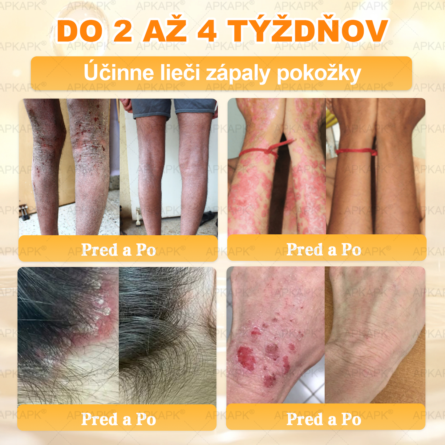 Odporúčané Univerzitnou nemocnicou Bratislava · Vyrobené na Slovensku✨✨ 𝖠𝖯𝖪𝖠𝖯𝖪® regeneračný krém na pokožku s včelím jedom