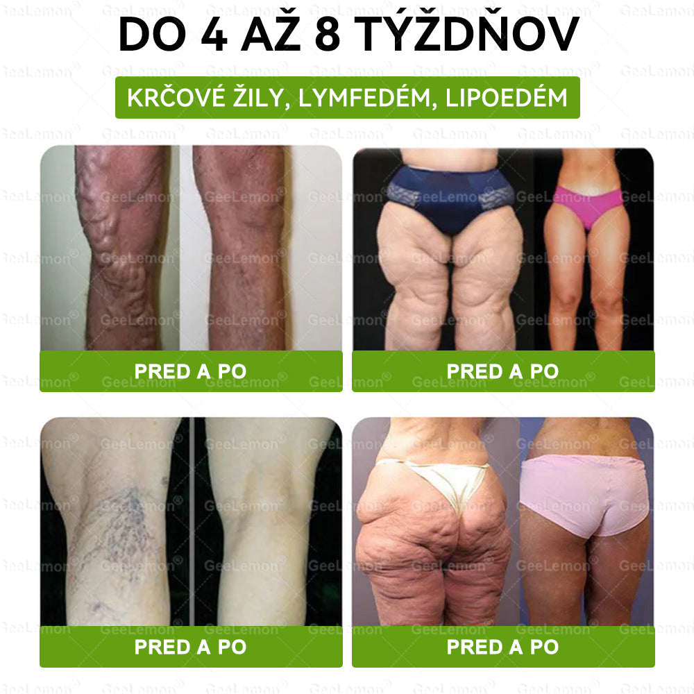 🎁 🎁 Vianočná zľava 50 % – len do Vianoc!